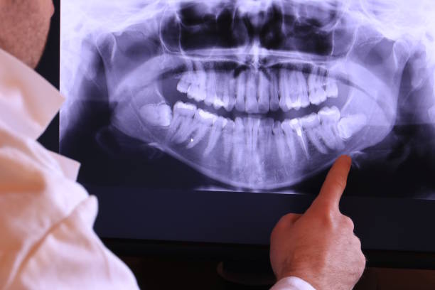 Best Emergency Broken Tooth Repair in Konterra, MD