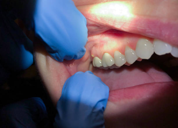Best Emergency Dental Care for Trauma or Injury in Konterra, MD